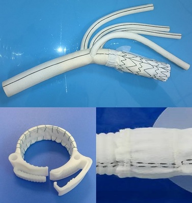免縫合帶支架四分支人工血管的研發(fā)及其臨床前研究